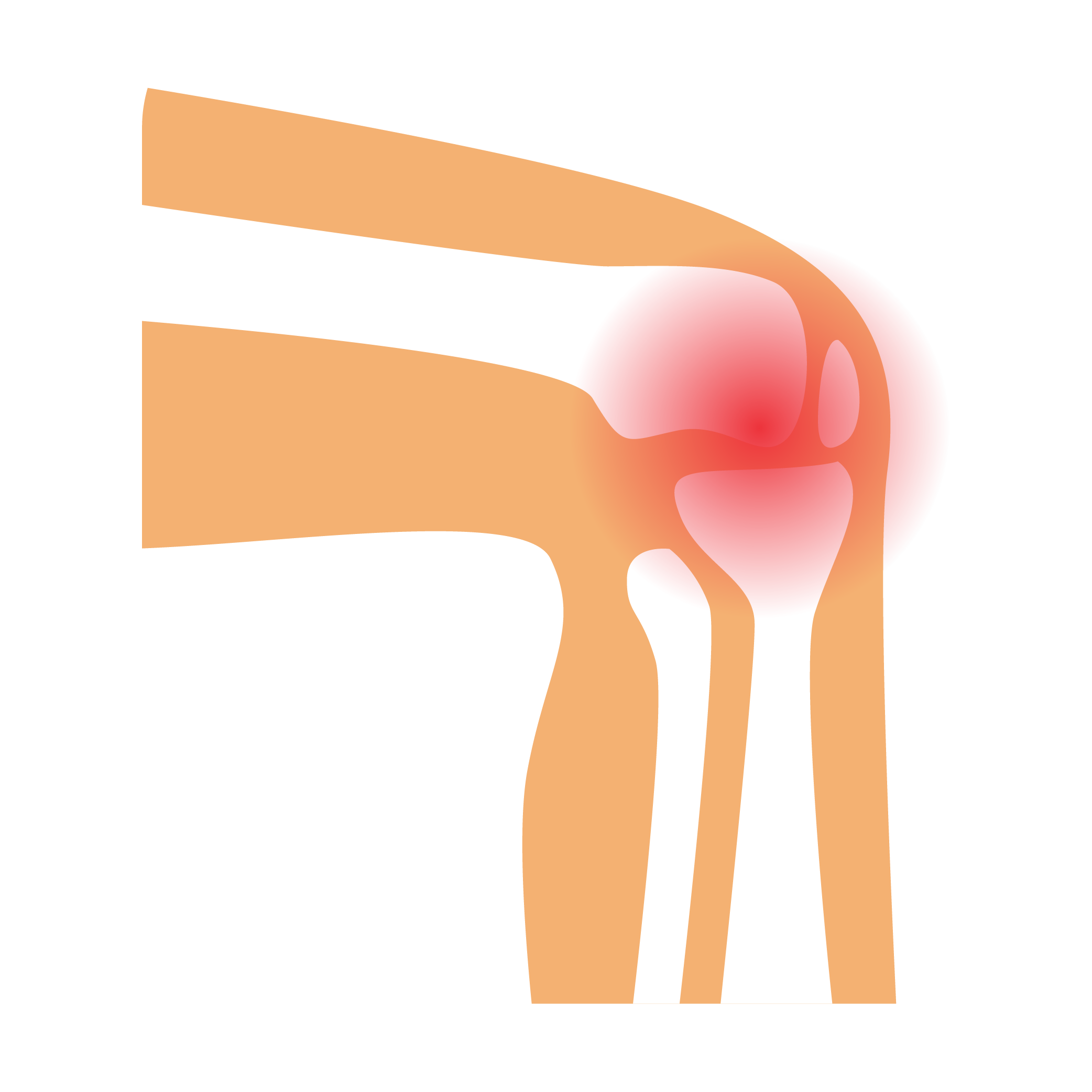 Knee Replacement icon